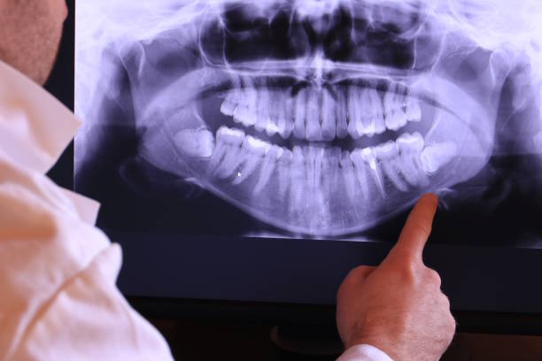 Emergency Dentist for Kids in AL