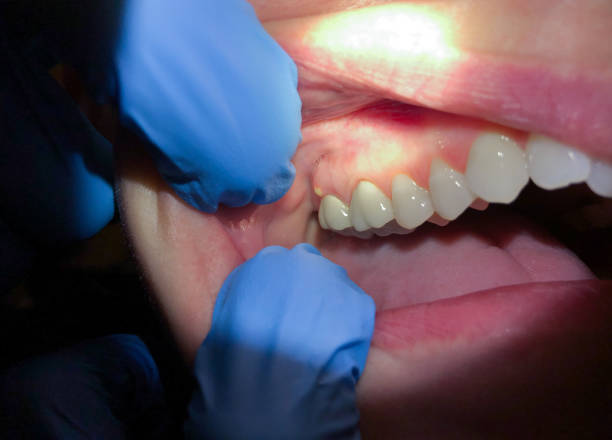 Best Broken Tooth Emergency  in Deatsville, AL